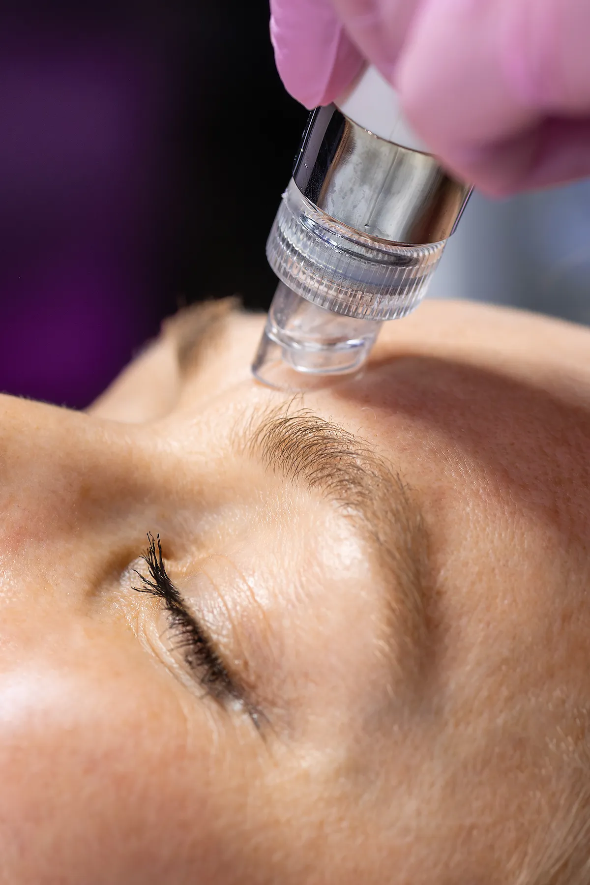 Close-up of the HydraFacial vortex wand resurfacing and hydrating skin at Nō Ka ʻOi Aesthetics in Lahaina, Maui