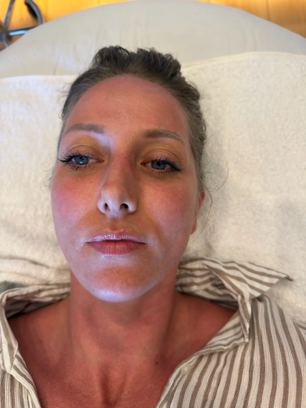 Guest immediately after her HydraFacial with a warm flush and hydrated skin