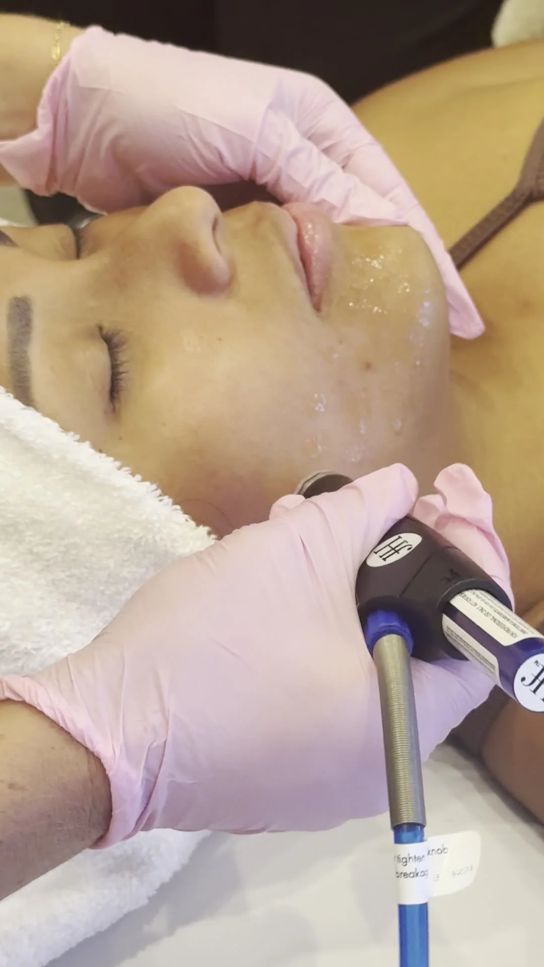 Close view of hydrating serum on the skin during a HydraFacial