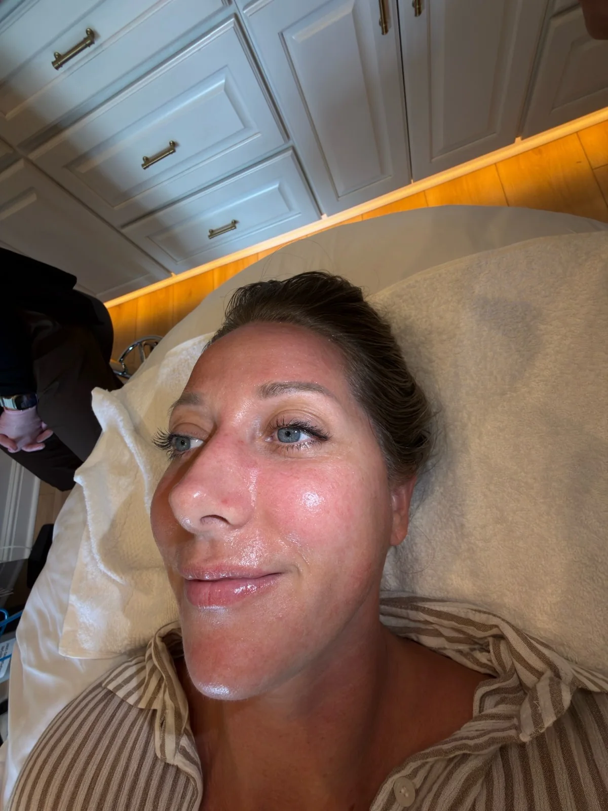 Close profile of a guest's dewy skin after a HydraFacial